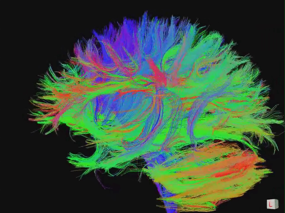 Brain connectome visualization